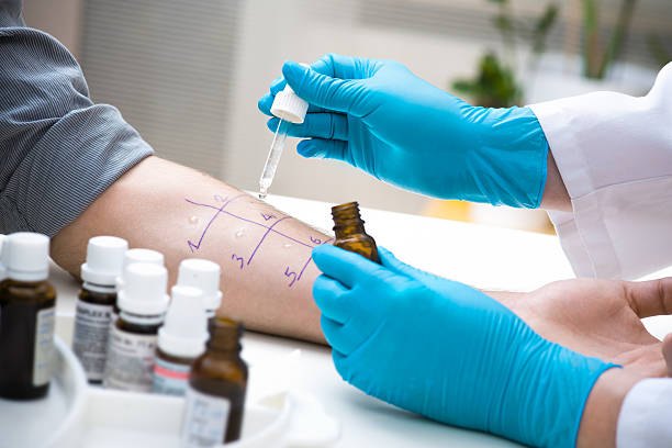 Allergy skin testing being performed on a patient’s arm